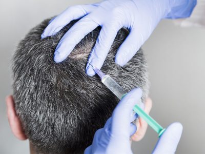 Keratin Takviyesi