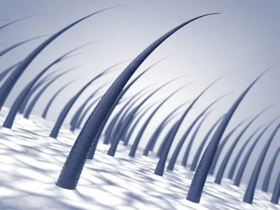 Saç lazeri tedavisi 