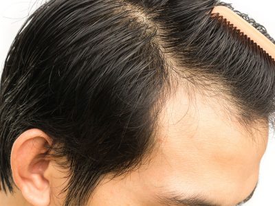 ekim yapılmadan öncesinde 