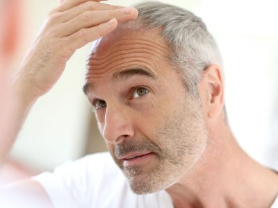 Erkeklerde saç dökülmesi genetik ve hormonal nedenlerden kaynaklanabilir.