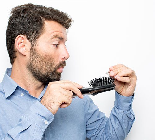 Saç ekimi soruları