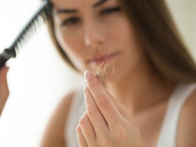 Kadınlarda saç dökülmesi hormonal nedenlerden kaynaklanabilmektedir.