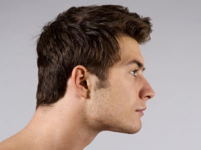 Orta saçlı deri bölgesinin oluşturulması