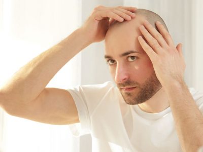 saç dökülmesi sorunu 