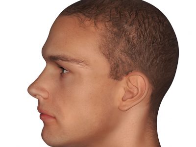 Saç Dökülmesi ve Kalp Sağlığı