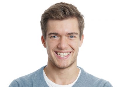 Saç ekimin tarihçesi