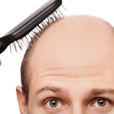 Saç Ektirmek Zararlımıdır