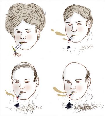 sigara saç dökermi