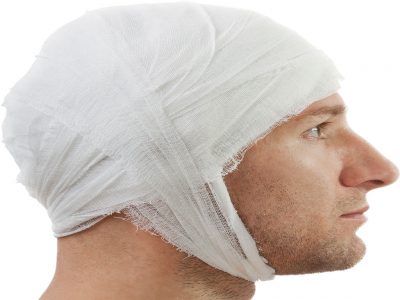 Yanıga bağlı saç dökülmesi için saç ekimi gerçekleştirilmektedir. 