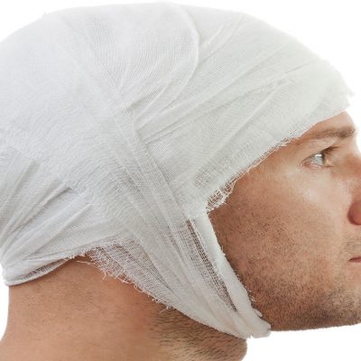 Yanıga bağlı saç dökülmesi için saç ekimi gerçekleştirilmektedir.